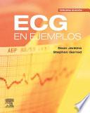 Libro ECG en ejemplos