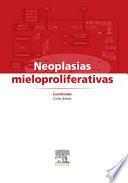 Libro Neoplasias mieloproliferativas