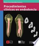 Libro Procedimientos clínicos en endodoncia