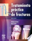 Libro Tratamiento práctico de fracturas